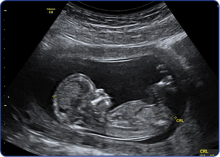 wow-l2-acfhp-id10001-10994.jpg